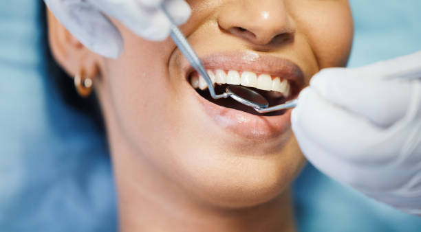 Best Lost Filling or Crown Replacement in Glide, OR